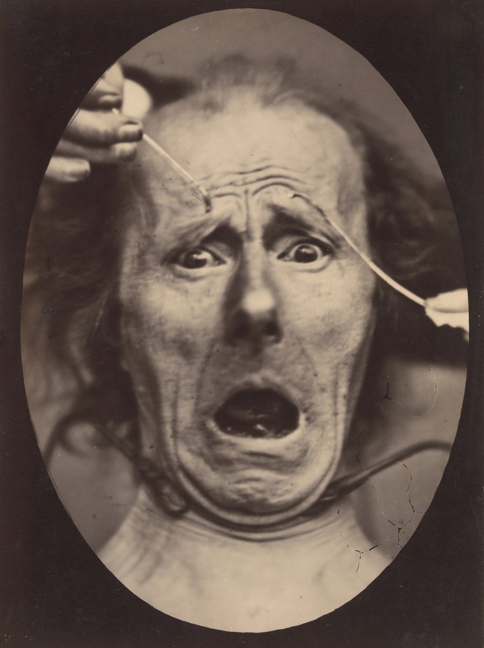 Electro-Physiologie, Obrázek 64, 1854-56, vytištěno 1862. od Adrien Alban Tournachon