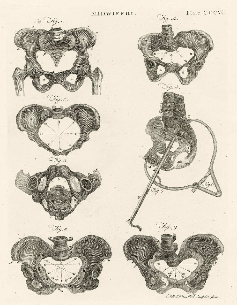 Porodnictví, ilustrace z 