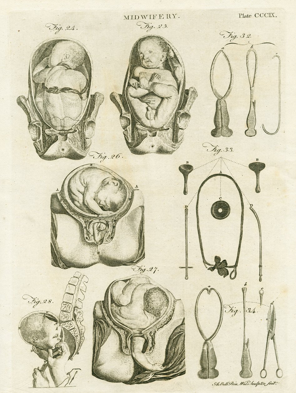 Porodnictví, ilustrace z 