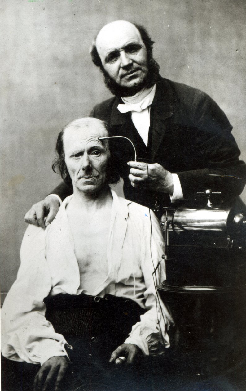 Duchenne de Boulogne s obětí pacienta, 1862 od French Photographer