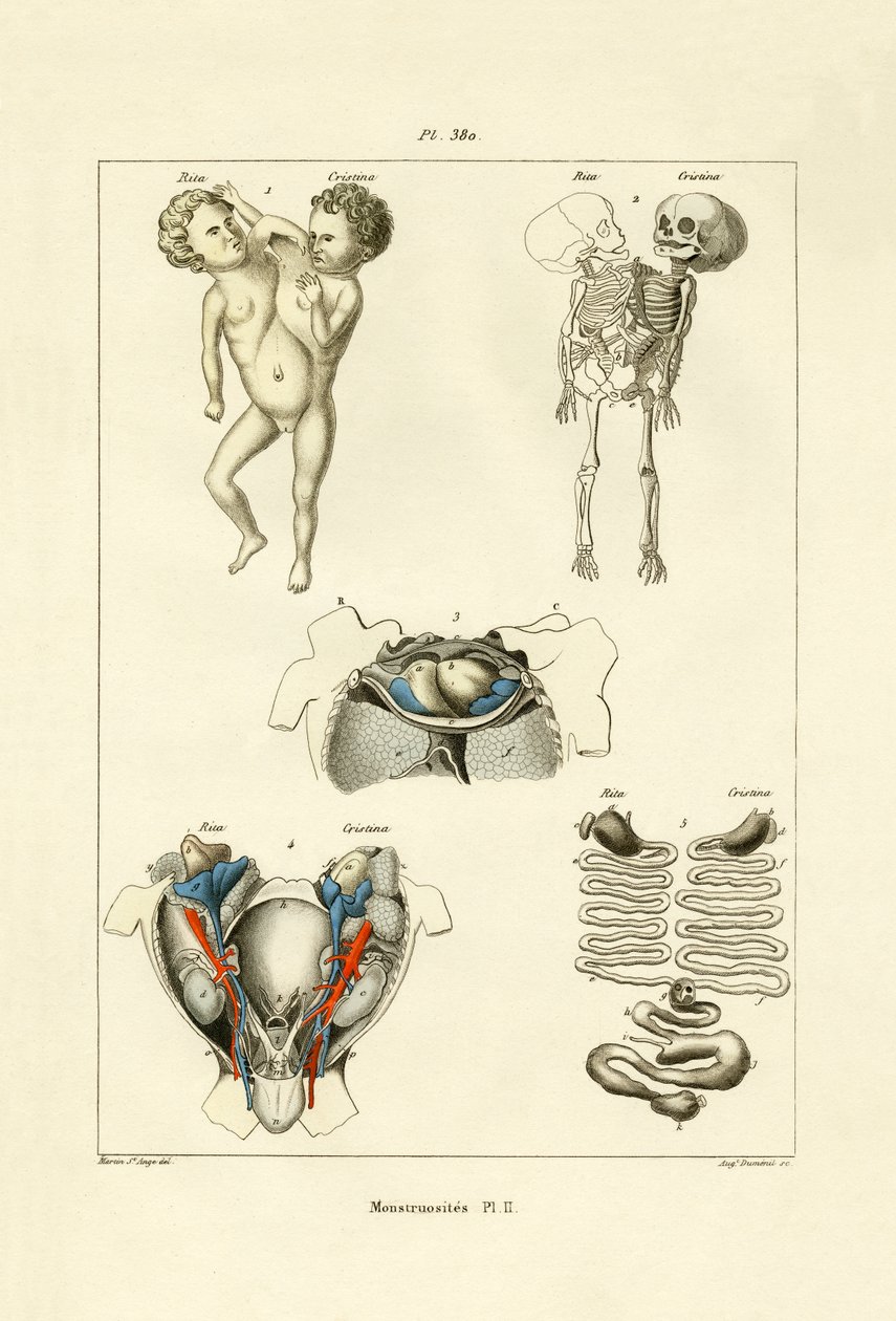 Freak, 1833-39 od French School