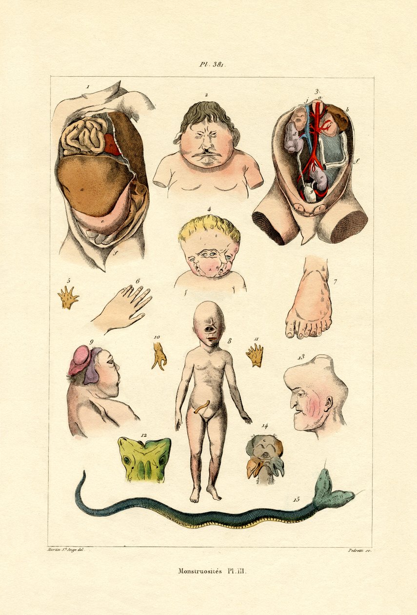 Freak, 1833-39 od French School
