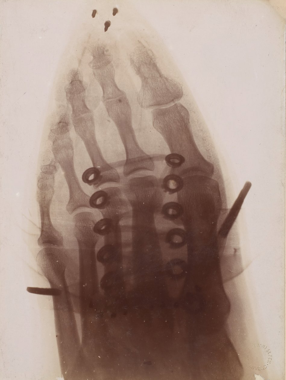 Noha skrz botu, 1896. od Henri van Heurck
