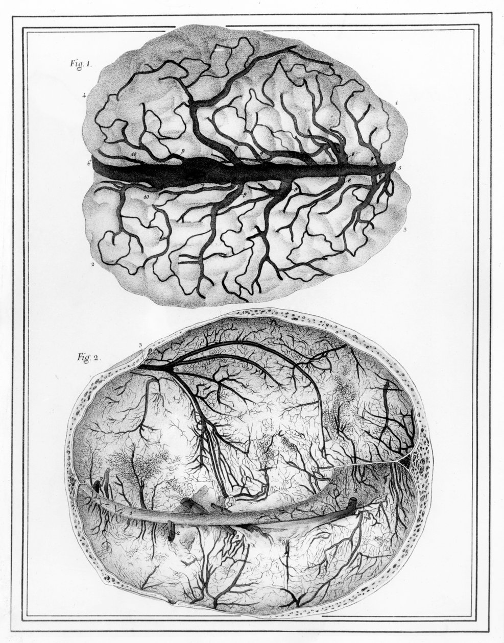 Mozek, 1825 od Jules Germain Cloquet