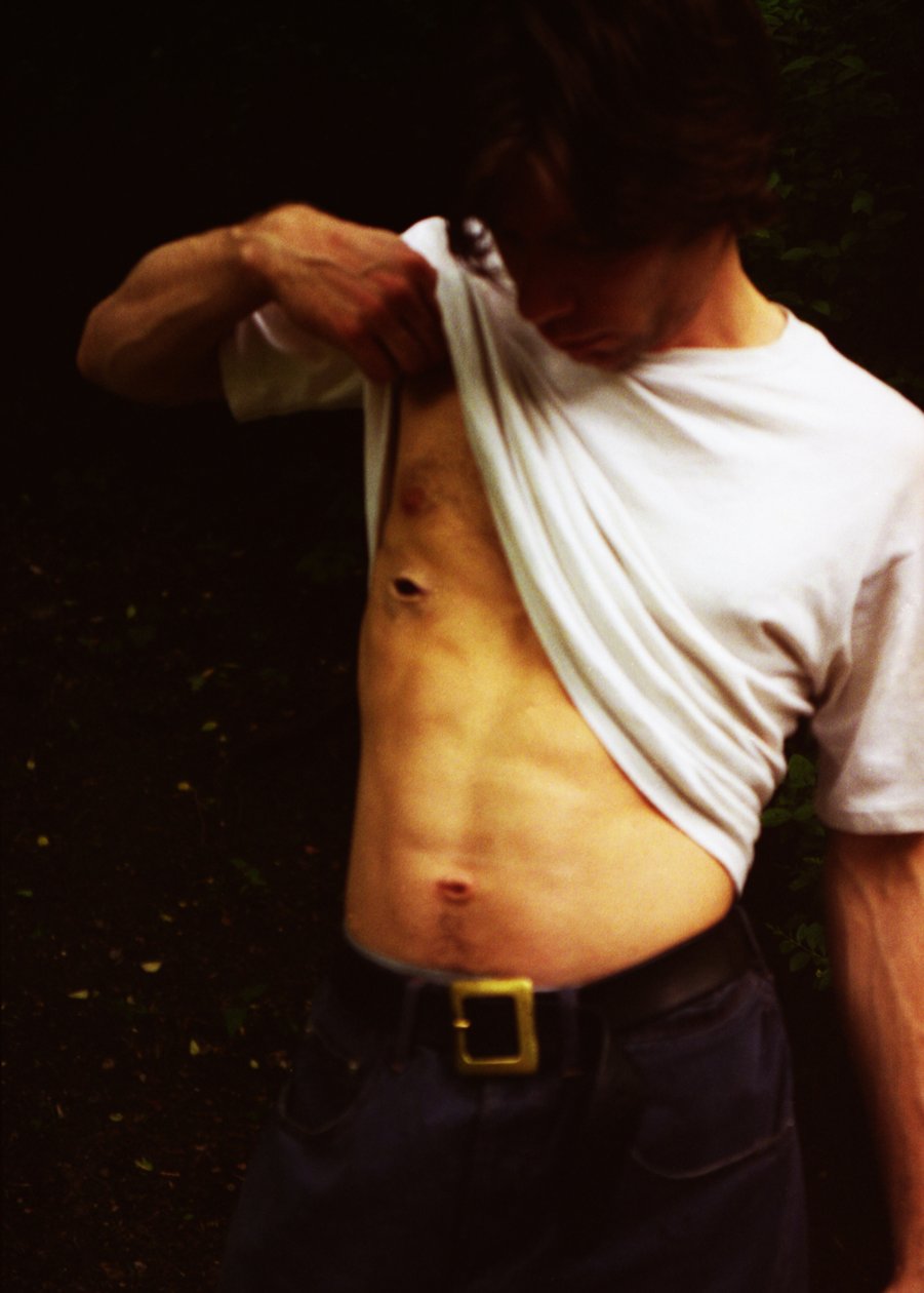 Rána od Mat Collishaw