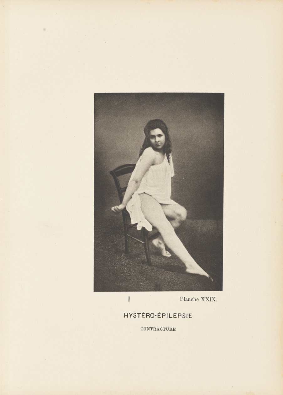 Hystero-epilepsická kontraktura od Paul Marie Léon Regnard