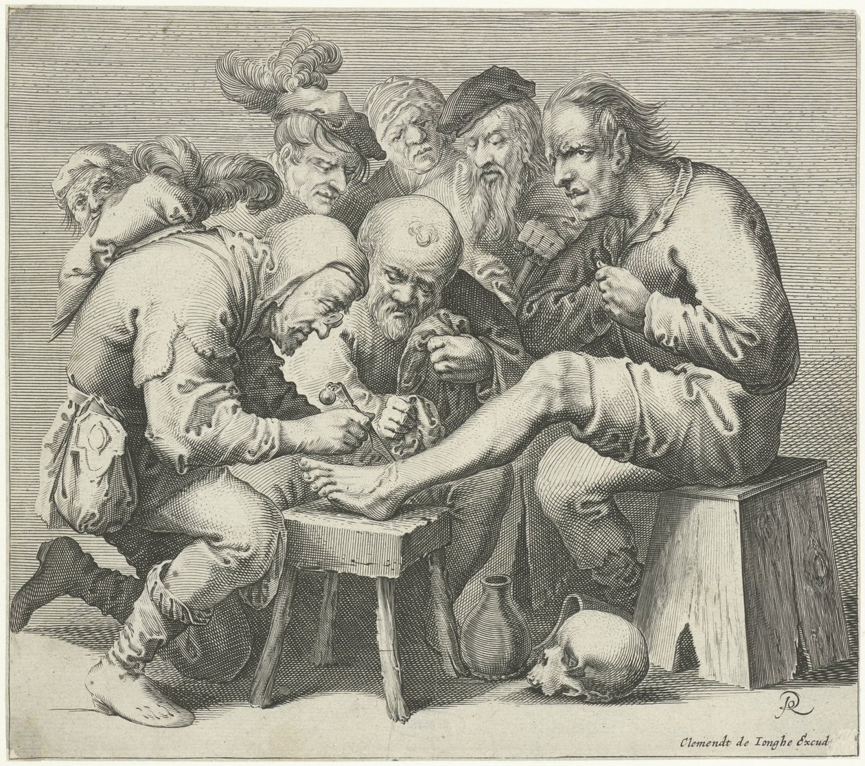 operace nohy od Pieter Jansz Quast