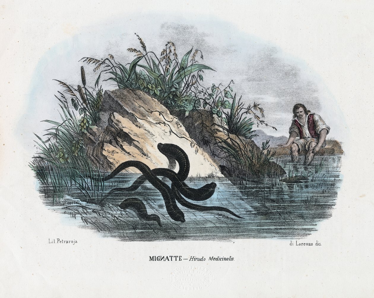 Pijavice, 1863-79 od Raimundo Petraroja