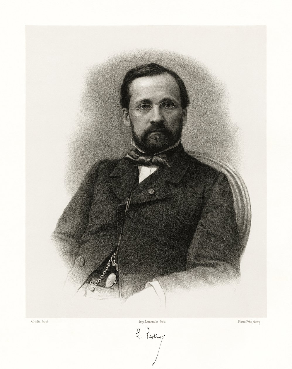 Louis Pasteur, 1865-66 od Schultz