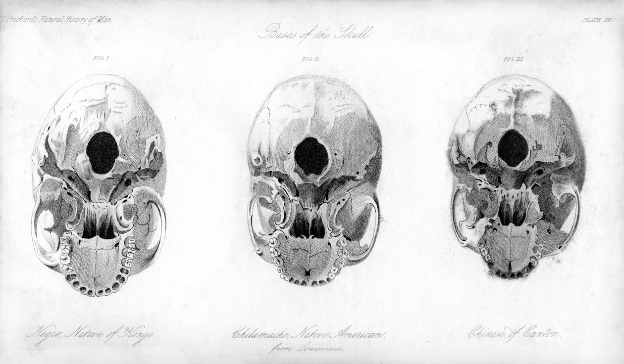 Základna lebky, 1848 od Unbekannt