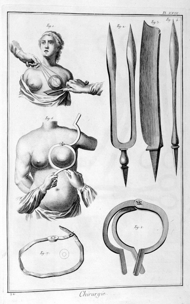 Operace prsu, 1751-1777 od Unbekannt