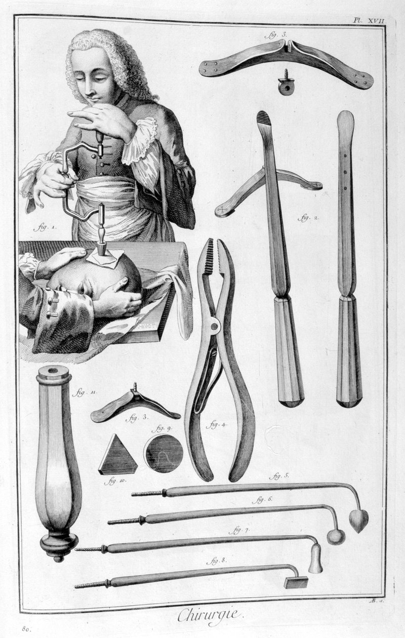 Chirurgie hlavy, 1751-1777 od Unbekannt
