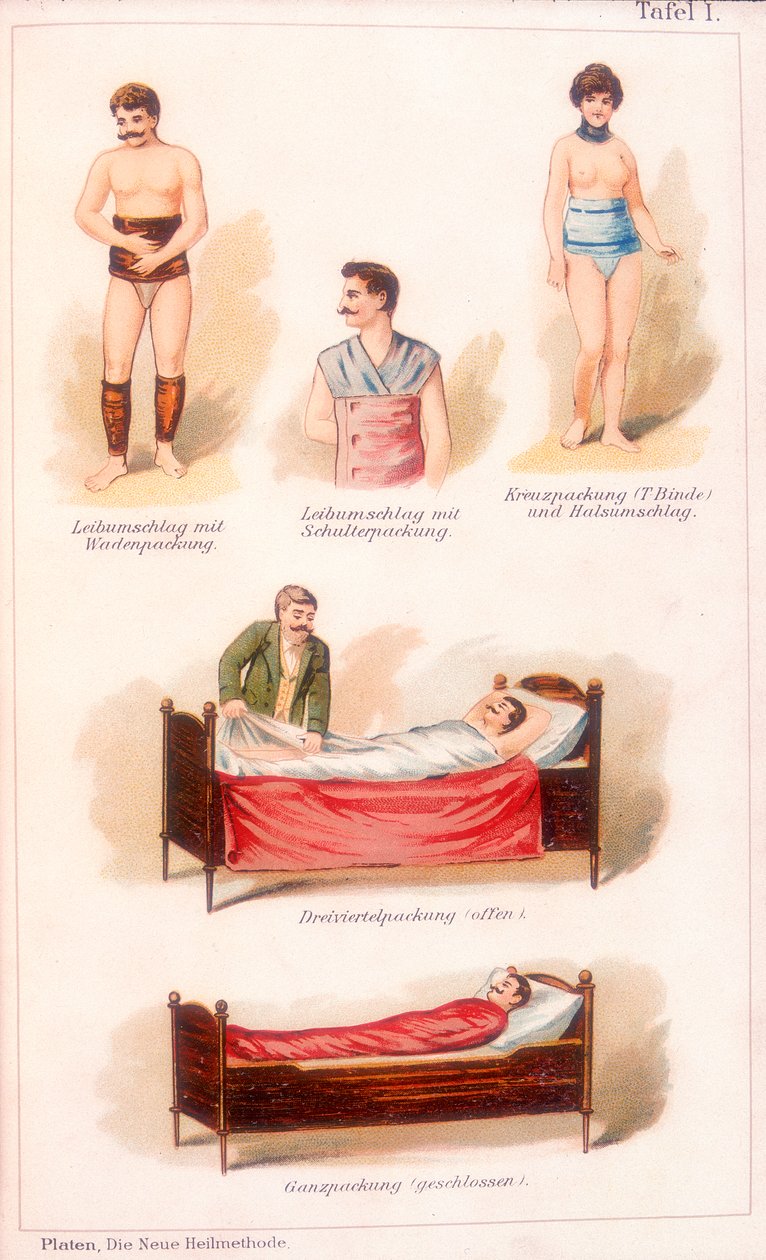 Hydroterapie, c1902 od Unbekannt