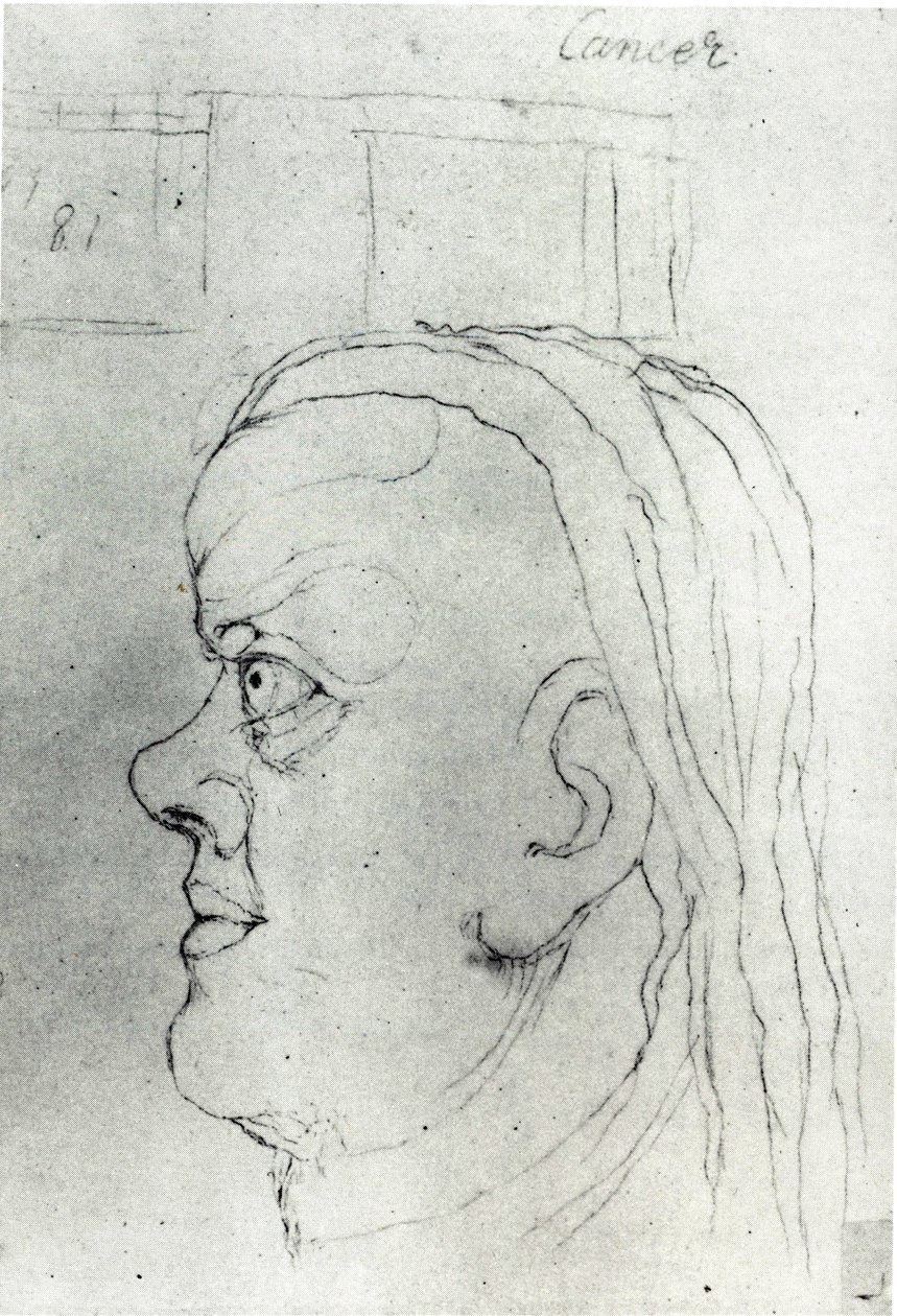 Vedoucí rakoviny od William Blake