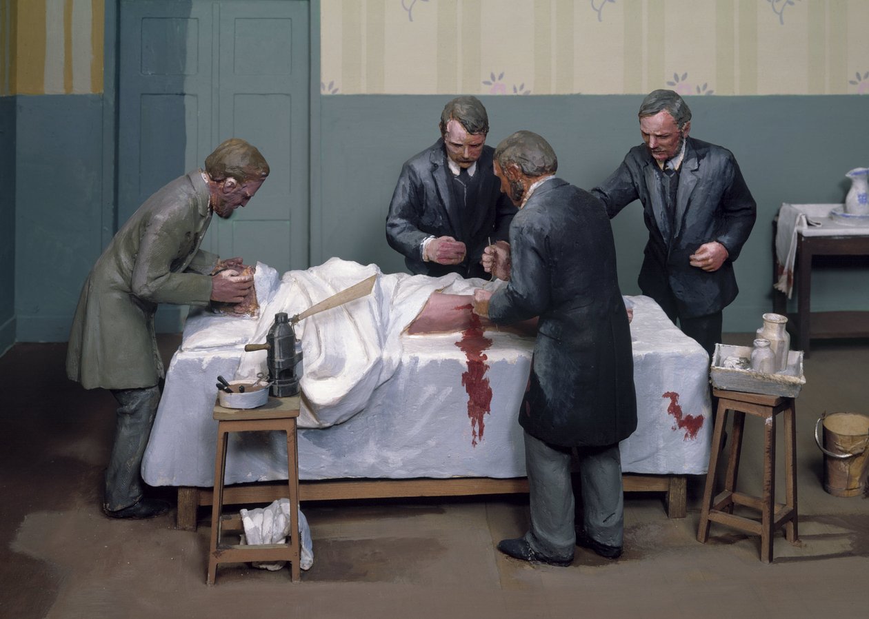 Chirurgická antiseptika Antiseptická operace od Ferdinand Georg Waldmuller