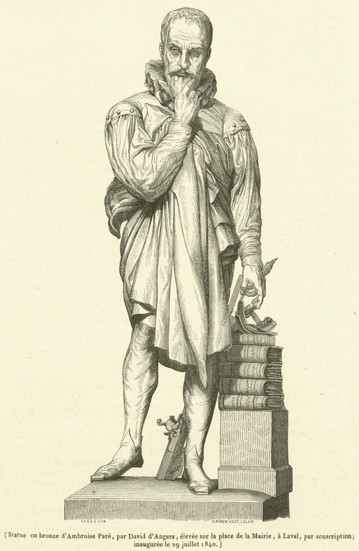 Bronzová socha Ambroise Pare (rytina) od French School