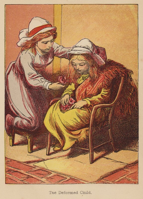 Deformované dítě (kolorovaná rytina) od Thomas Dalziel